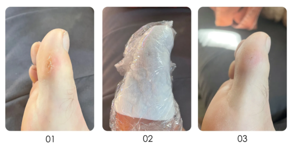 Burst_exfoliating gel (3)