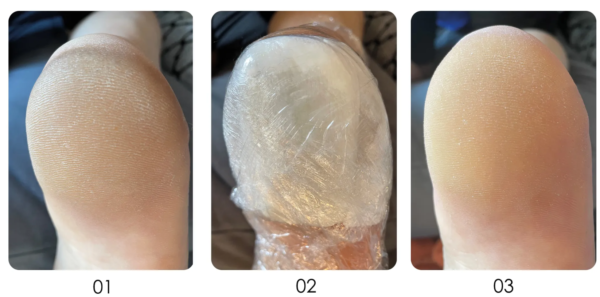Burst_exfoliating gel (4)